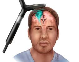 Brain Anatomy Projects :: Photos, videos, logos, illustrations and branding  :: Behance