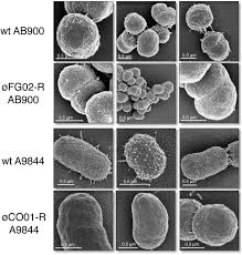 Image result for Striga baumannii