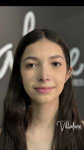 Uhhhh hermona nariz, increíble cambio, sonrisa genial