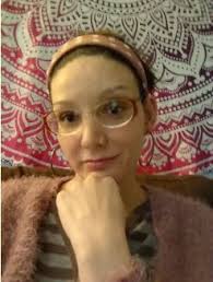 Profiles of Adults with JS