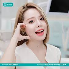 Dáng răng tròn oval phù hợp với gương mặt nào?