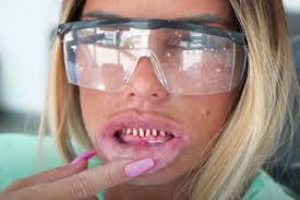 People have been warned about the potential risk of travelling abroad for  cheaper cosmetic dental treatment. The trend is dubbed 'Turkey teeth' as  people are choosing to go to countries such as