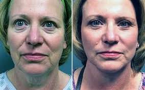 Meet Our Staff at Reveal Beauty