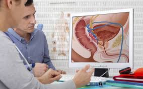 Most men with early prostate cancer don't have changes that they notice. Targeted Screening For Prostate Cancer Could Prevent One In Six Deaths Ucl News Ucl University College London