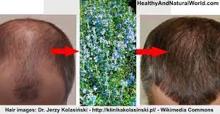 In theory, applying rosemary oil to the scalp, and leaving it on for longer periods, could enhance its effects. How To Use Rosemary For Treating Hair Loss