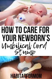 How To Care For Your Newborn S Umbilical Cord Stump Newborn Tips For New Moms Newborn Tips And Tricks New Mom Tips Newborn Newborn Newborn Care Baby Sleep