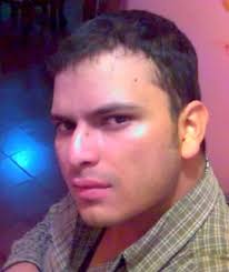 People balding in their 20s