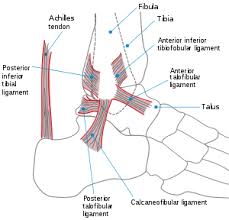 A full examination once any pain and swelling. Sprained Ankle Wikipedia