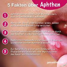 Sie können jedoch die lebensqualität enorm einschränken und brauchen teilweise ziemlich. Aphthen Schmerzhafte Blaschen Im Mund Gesundheit De