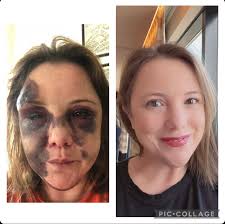 Hello thank you for the add. I'm an alumni of Azure Acres from May 2000.  Sobriety date is 10/11/16. I didn't stay sober after leaving but am  grateful for the time I