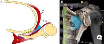 Image result for Scapulothoracic Injection