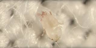 Image result for Dust mite