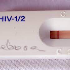 Where to test for hiv & stis: Hiv Home Testing Kits At Your Corner Chemist