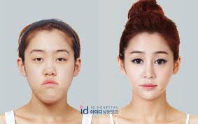 South korea is one of the most technologically advanced and digitally linked countries in the world. The Crazy Transformations On South Korea S Controversial Plastic Surgery Reality Show