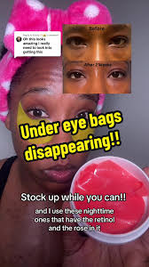 Havogen 5 Patches Review