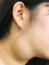 Your throat is a muscular tube that begins behind your nose and ends in your neck. Neck Lumps Ent Clinic Melbourne Mr Charles Giddings Associate Professor Joanne Rimmer