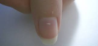 Maybe you would like to learn more about one of these? Te Falta Calcio La Verdadera Razon Por La Que Aparecen Manchas Blancas En Las Unas Investigaciones The Epoch Times En Espanol