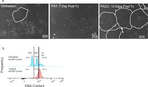 Cells in the polyaneuploid cancer cell (PACC) state have increased  metastatic potential | Clinical & Experimental Metastasis