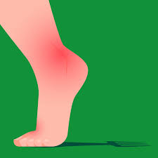 Image result for gout