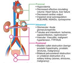 Image result for Postrenal Failure
