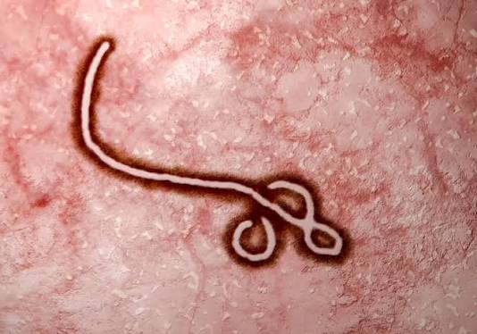 Ébola: qué es y definición médica | Diccionario CUN