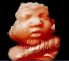 Klinik PrimaMedik Temerloh