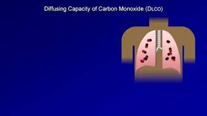 Image result for Diffusing Capacity