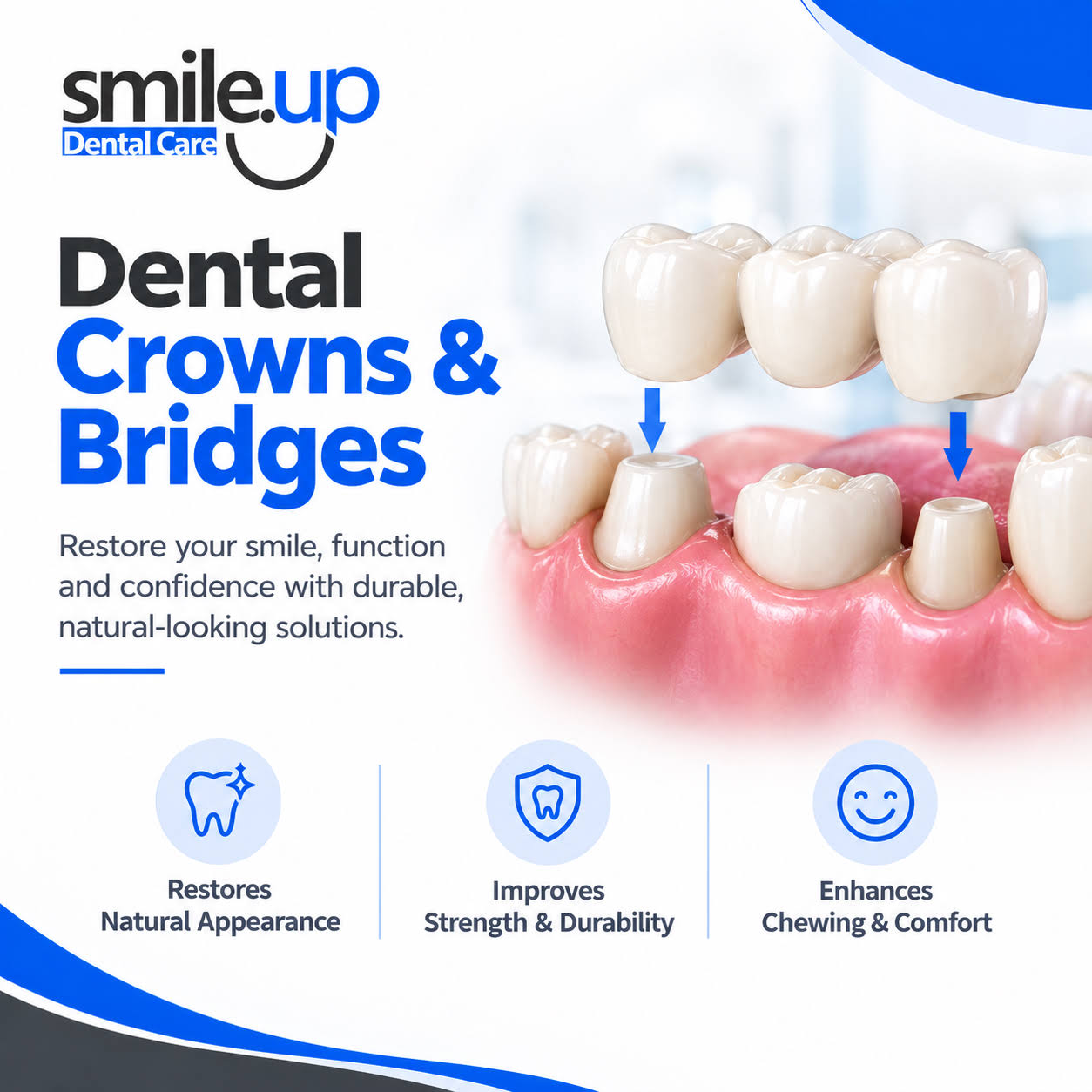 Dental Crowns & Bridges product image