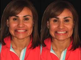 Adrian Valera (drjadrianvalera)