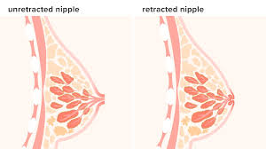 Touch Inverted Nipples - Hard for Action