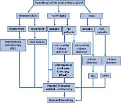 Image result for Sialolithiasis