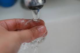 There are steps you can take to lighten or remove the dye. 6 Ways To Remove Hair Dye From Skin Wikihow