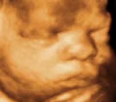 By designing our facility with comfort and relaxation in mind. 3d 4d 5d Ultrasound Lowest Prices Best Service Brooklyn New York Queens Manhattan Bronx Staten Island Near Me