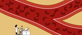 Sickle cell anemia is an inherited red blood cell disorder in which there aren't enough healthy red blood cells to carry signs and symptoms of sickle cell anemia usually appear around 5 months of age. One Doctor S Approach To Treating People With Sickle Cell Disease Commonwealth Fund