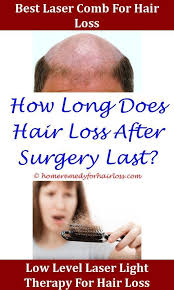 But, even for those who don't consume iodized salt, one egg alone contains 24 mcg. Hair Loss Kenalog Side Effects Hair Loss Diphenhydramine Hydrochloride Hair Loss Ammonium Lauryl Sulfate Shampoo Hair Hair Loss Hair Loss Men Patchy Hair Loss