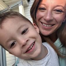 Is it normal for an English Lab to lose hair in Jan/Feb?