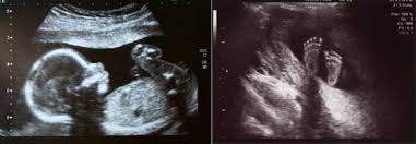 Funny responses to wanna hook up. Pregnancy Obstetric Focus Ultrasound