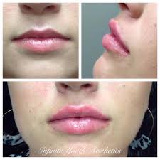 Reviews of INFINITE YOUTH Aesthetics & Lash Studio