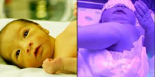 Artikel juga membincangkan tentang peri pentingnya penyusuan bayi yang merupakan petua hilangkan kuning bayi paling berkesan dan selamat. Bayi Anda Alami Demam Kuning Cuba 8 Tips Mudah Atasinya 100comments Product Reviews Samples News