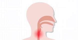 Image result for Epiglottitis