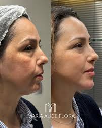 Clínica MA Flora (@clinicamariaaliceflora) • Instagram photos and videos