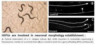 The congenital mirror movements begin in infancy and persist throughout the patient's life, often joubert syndrome is a rare autosomal recessive genetic disorder that affects the cerebellum, an area. Rett Atypic Syndrome And Congenital Mirror Movement Disorder Cermo Fc