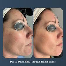 Professional Skin Solutions