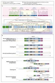 Williams Beuren Syndrome Nejm