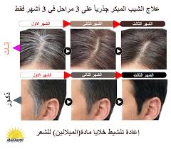 علا ج الشيب المبكر جذريا في 3 أشهر