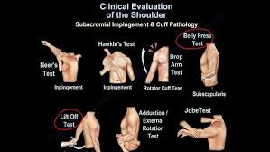 Image result for Shoulder Instability Exam
