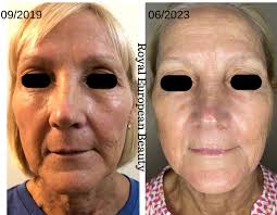 Royal European Beauty