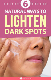 Laser treatments and chemical peel sessions are known to reduce the prominence of dark spots. How To Remove Dark Spots On Face Fast 6 Home Remedies In 2020 Spots On Face Dark Spots On Face Lighten Dark Spots