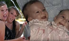 Maybe you would like to learn more about one of these? Conjoined Twins Abby And Brittany Hensel Enjoy Successful Careers