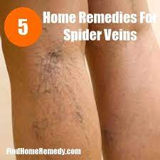 Pin On Home Remedies
